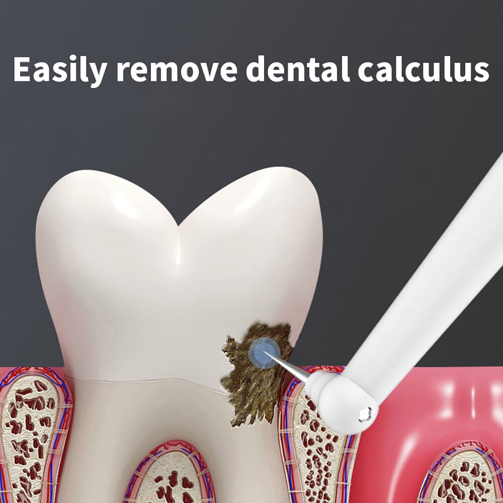 Multifunctionele Dubbele-Head Elektrische Tandenborstel Voor Tandsteen, Tandheelkundige Vlekken, Tandplak, Rook Vlekken, dental Cleaning