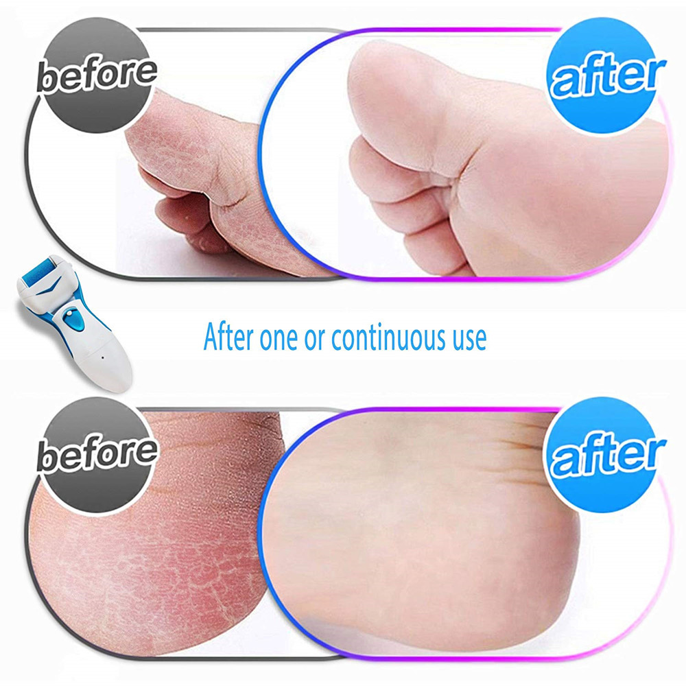 Lima eléctrica para pies de costura, herramienta roja para el cuidado de los pies, máquina de pedicura, rodillo para pelar la piel, Lima removedora de callos para Talón de hombre, novedad