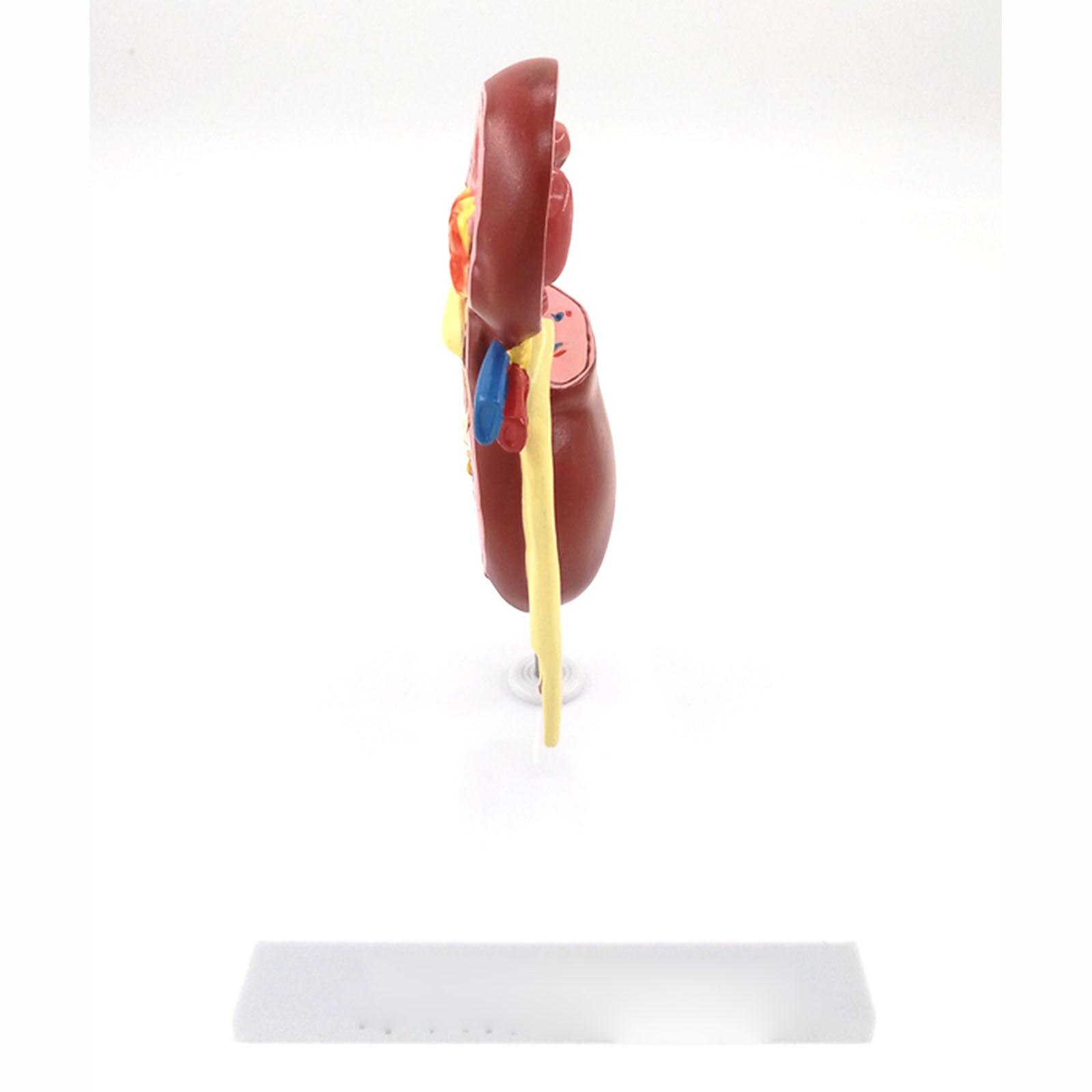 Zieke Nier Model Human Anatomisch Medische Pathologische Veranderingen Specimen Voor Patiënt Onderwijs Onderwijs Middelen