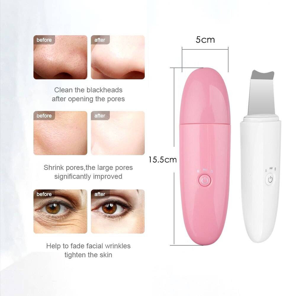 Ultrasonic Atomization Peeling Machine Skin Scrubber Vibration Face Spatula Blackhead Remover Deep Face Cleaning Machine Peel
