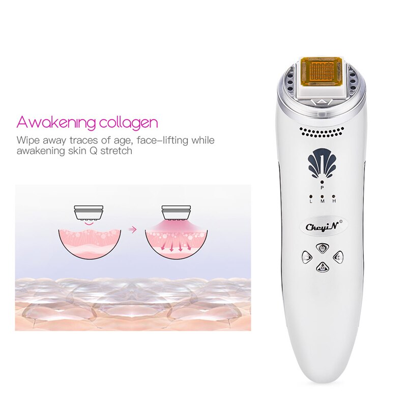 Rf Radio Frequentie Huid Gezichtsverzorging Lifting Aanscherping Rimpel Verwijderen Facial Lifting Whitening Oplaadbare Body Massage Machine