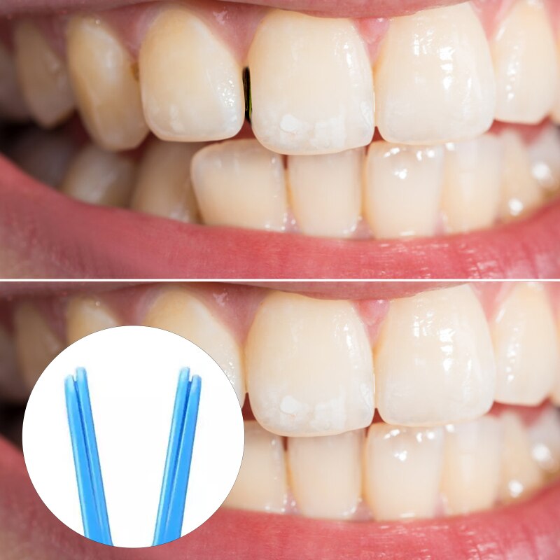 Dental Floss Flosser Y Shape Handle Interdental Teeth Cleaning Stick Tools Aid Oral Hygiene Toothpicks Cleaner Safety Oral Care