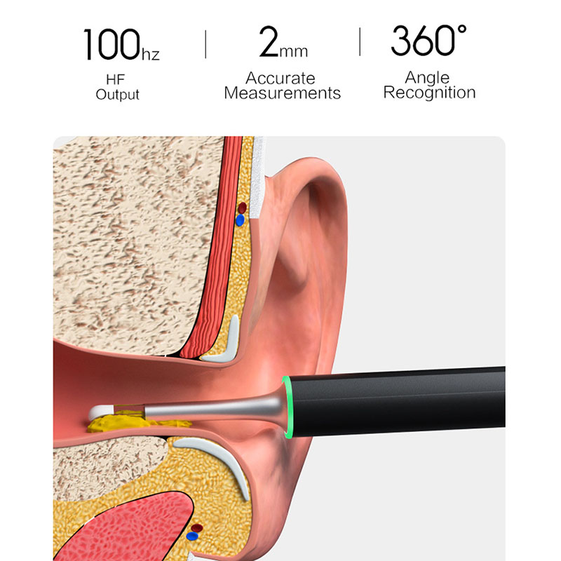 Bebird – embout d&#39;oreille X17 pro, Endoscope visuel intelligent, 300W, Mini caméra, boroscope, avec Base de chargement magnétique, Original