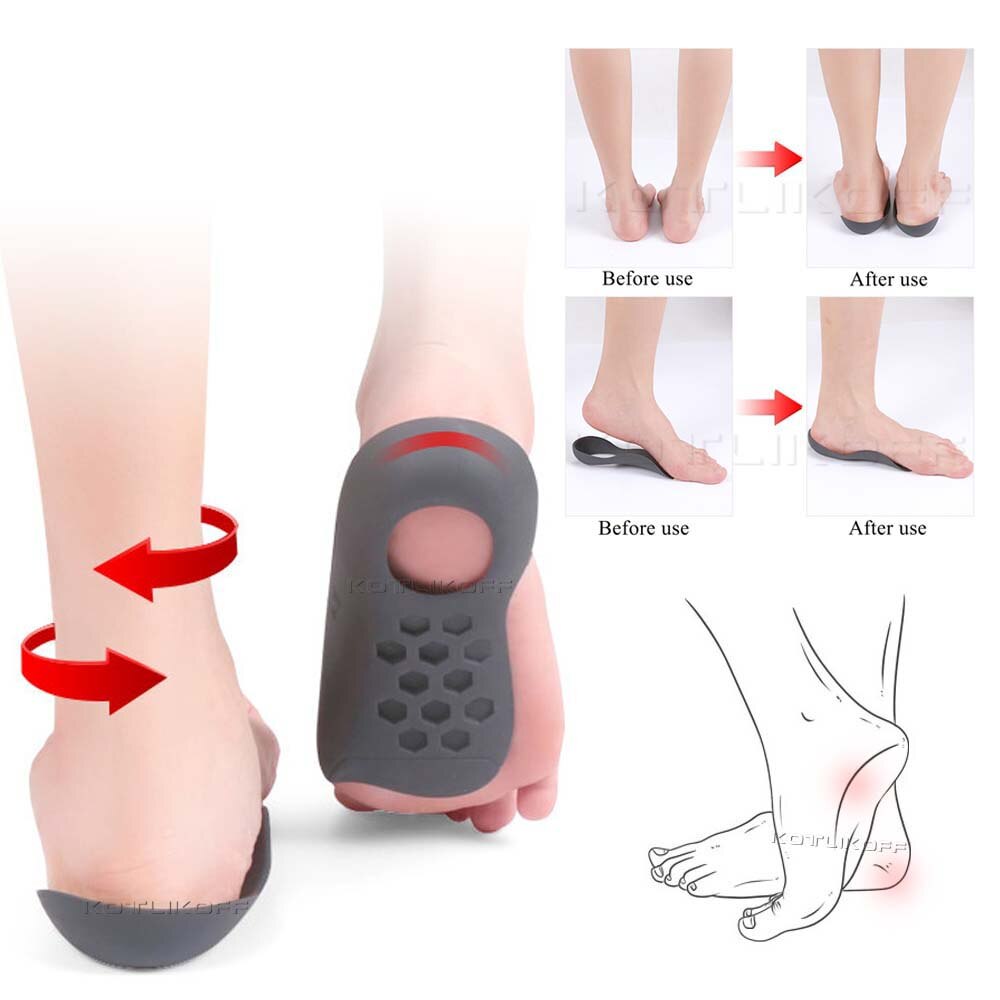 Orthotic Flat Feet Insoles for Arch Support O/X Leg Corrective Foot Care Pads Plantar Fasciitis Half Inserts Shoes Sole Insole