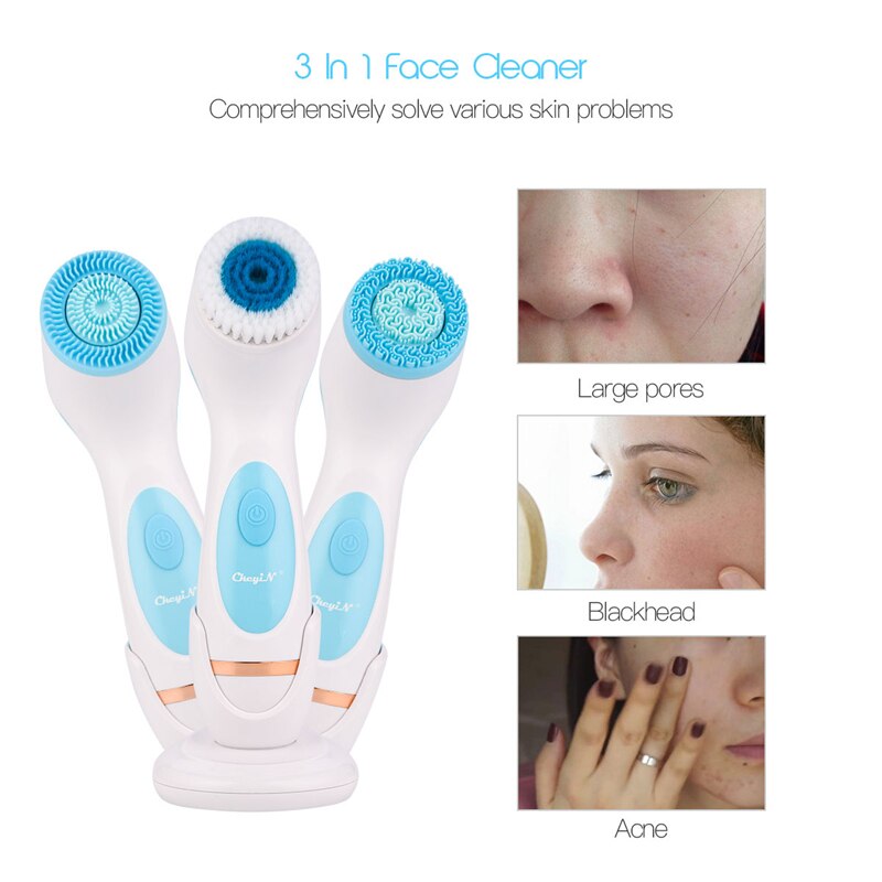 CkeyiN-limpiador Facial ultrasónico con vibración, cepillo Facial limpiador profundo, exfoliador de eliminación de espinillas, cuidado de la piel