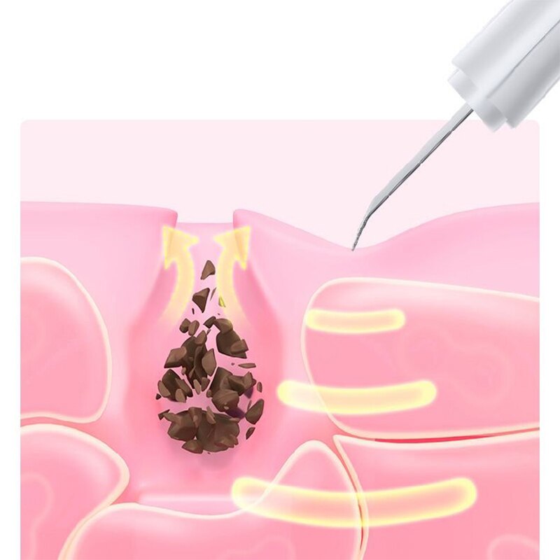 Xiaomi Ultrasuoni lavasciuga della pelle vibrazione spatola per il viso rimozione di punti neri lavasciuga facciale pala pulizia cavitazione peeling sollevamento facciale