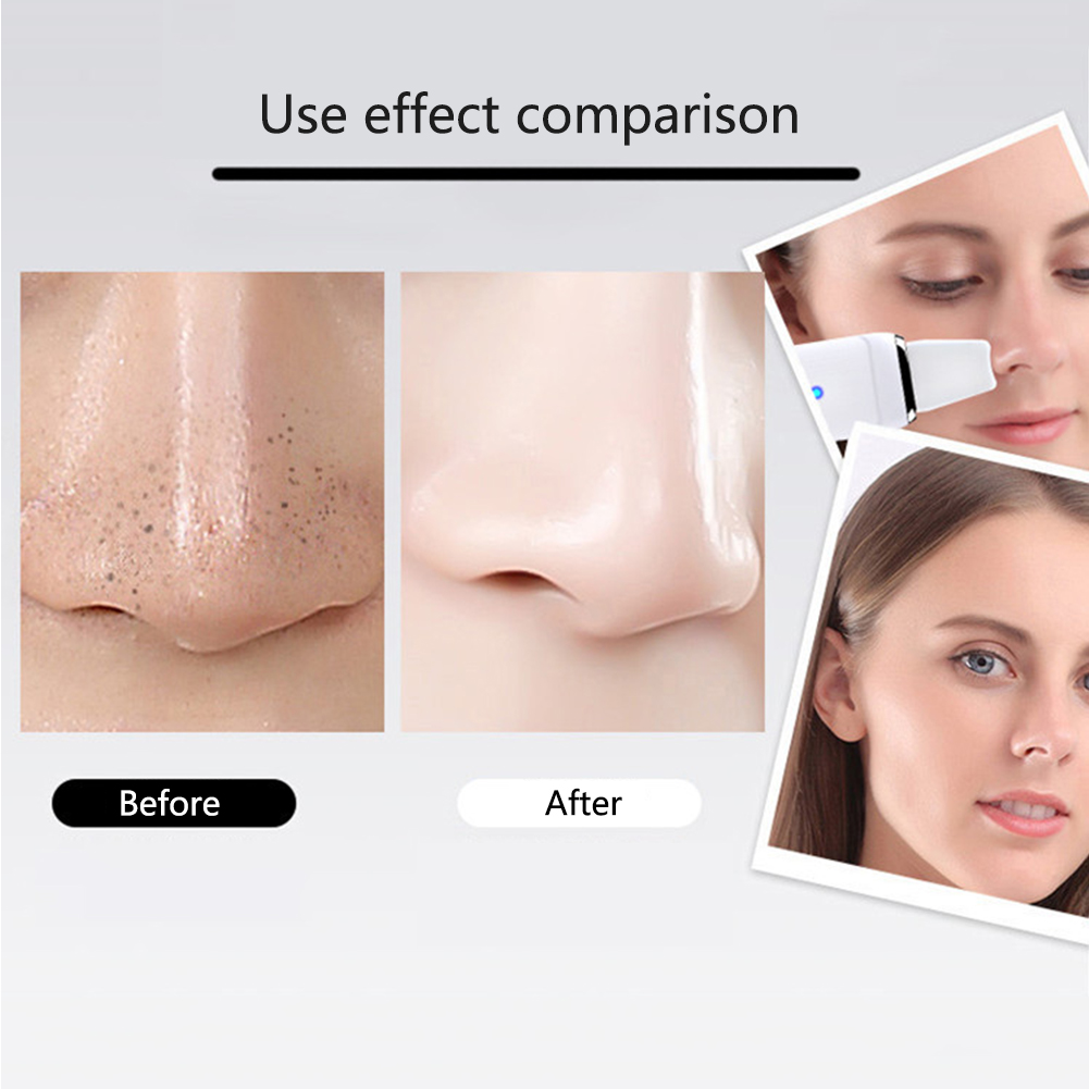 Ultrasonic Ion Skin Scrubber Deep Cleaning Pore Cleaner Blackhead Remover Vibrating Facial Cleansing Skin Spatula Instrument