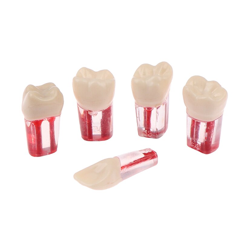 2 uds. De resina endodoncia Dental, modelo de diente Endo, limas de conducto radicular, práctica de pulpa