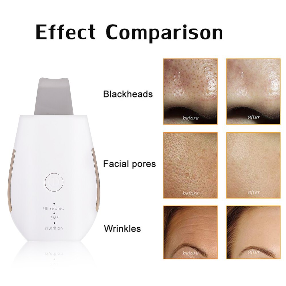 Ultrasonic Scrubber Deep Cleansing Skin Scrubber Face Cleansing Shovel Exfoliating Skin Scraper Peeling Facial Lifting Peeling