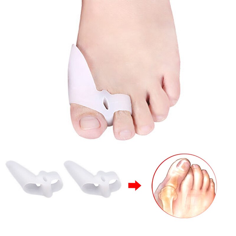 Pexmen 2 Teile/para Gel Zehe Separator Ballen Knochen Ektropium Erzähler Zehen Außen Gerät Fuß Pflege Werkzeuge Hallux Valgus Korrektor: Blau