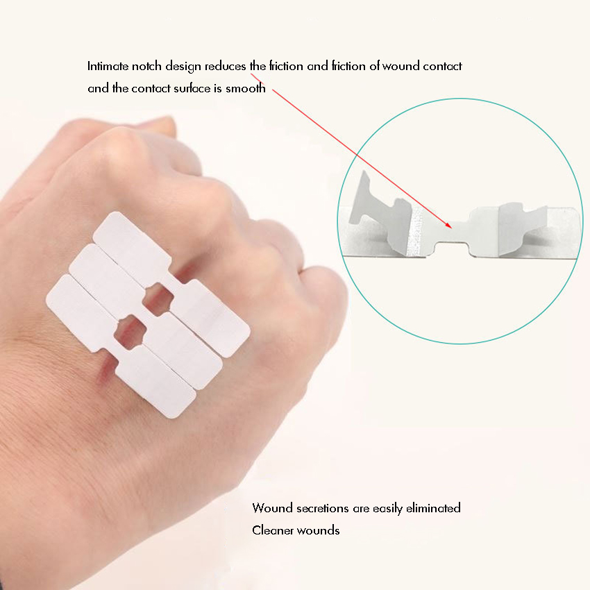 10PCS/Lot Butterfly Closure Strips, Adhesive Wound Closure Bandages, Sterile Bandages for Wound Protection, Single Use
