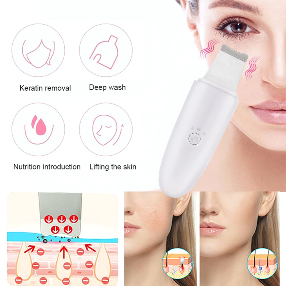 Multifunction Blackhead Removal Equipment Beauty Remove Clear USB Charging White/Pink EMS Pore Contraction Woman