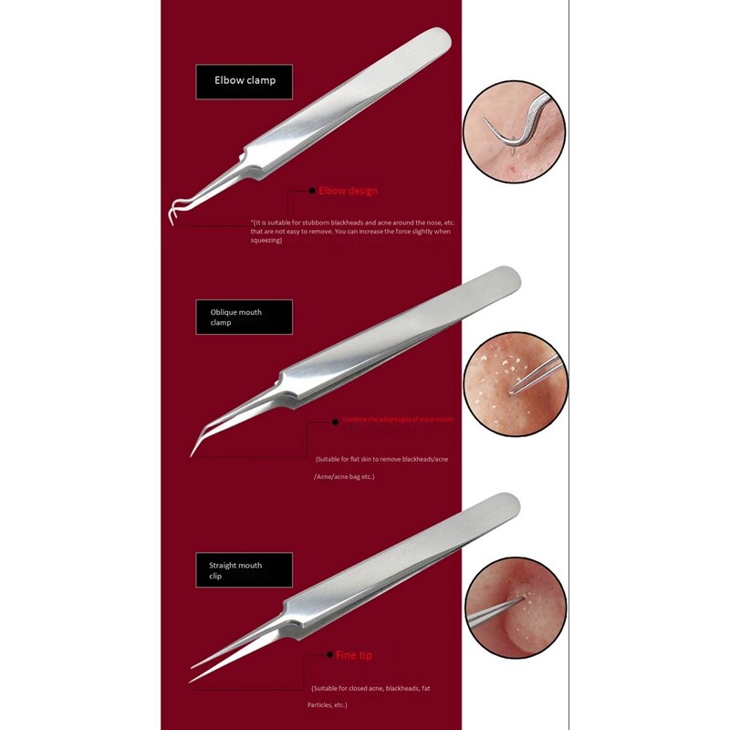 Acne Nose Blackhead Remover White Head Tool Pimple Removal Needle