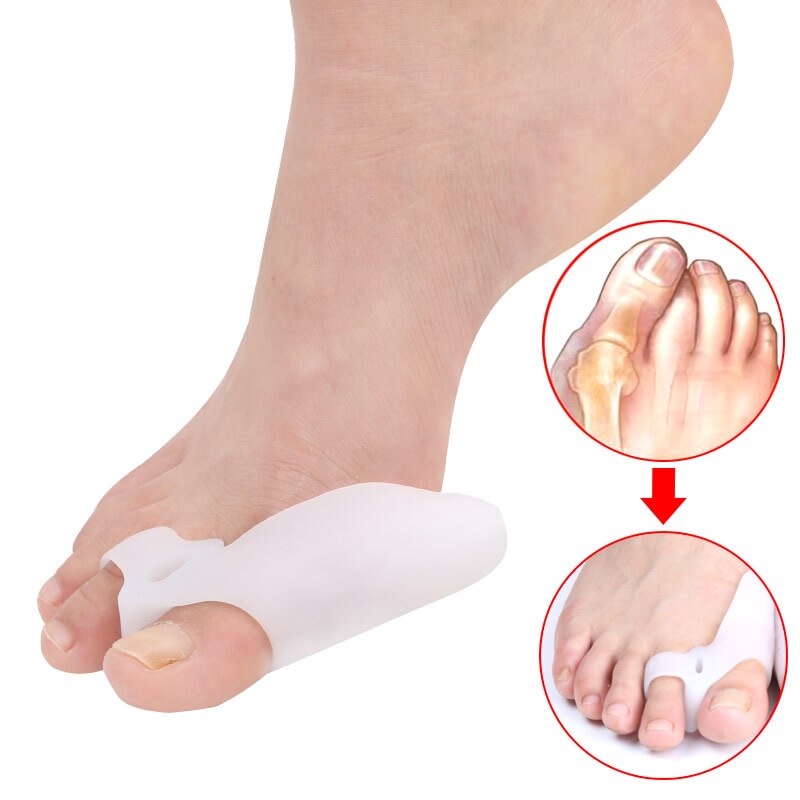 9 Pcs/set Orthopedic Bunion Correction Pedicure Socks Silicone Hallux Valgus Corrector Braces Toes Splitter Set