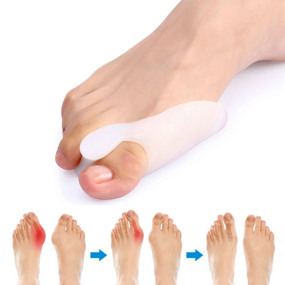 Demine Silikon Gel Zehe Separator gerader Daumen Zehe Hallux Valgus Orthese Fuß Schutz Zehe Rohr Hülse Pedikübetreffend Kappe Einsatz