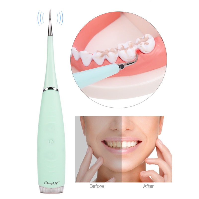 Elektrische Dental Scaler Sonic Siliconen Tooth Cleaner Oplaadbare USB Tand Calculus Remover Vlekken Tandsteen Verwijderen