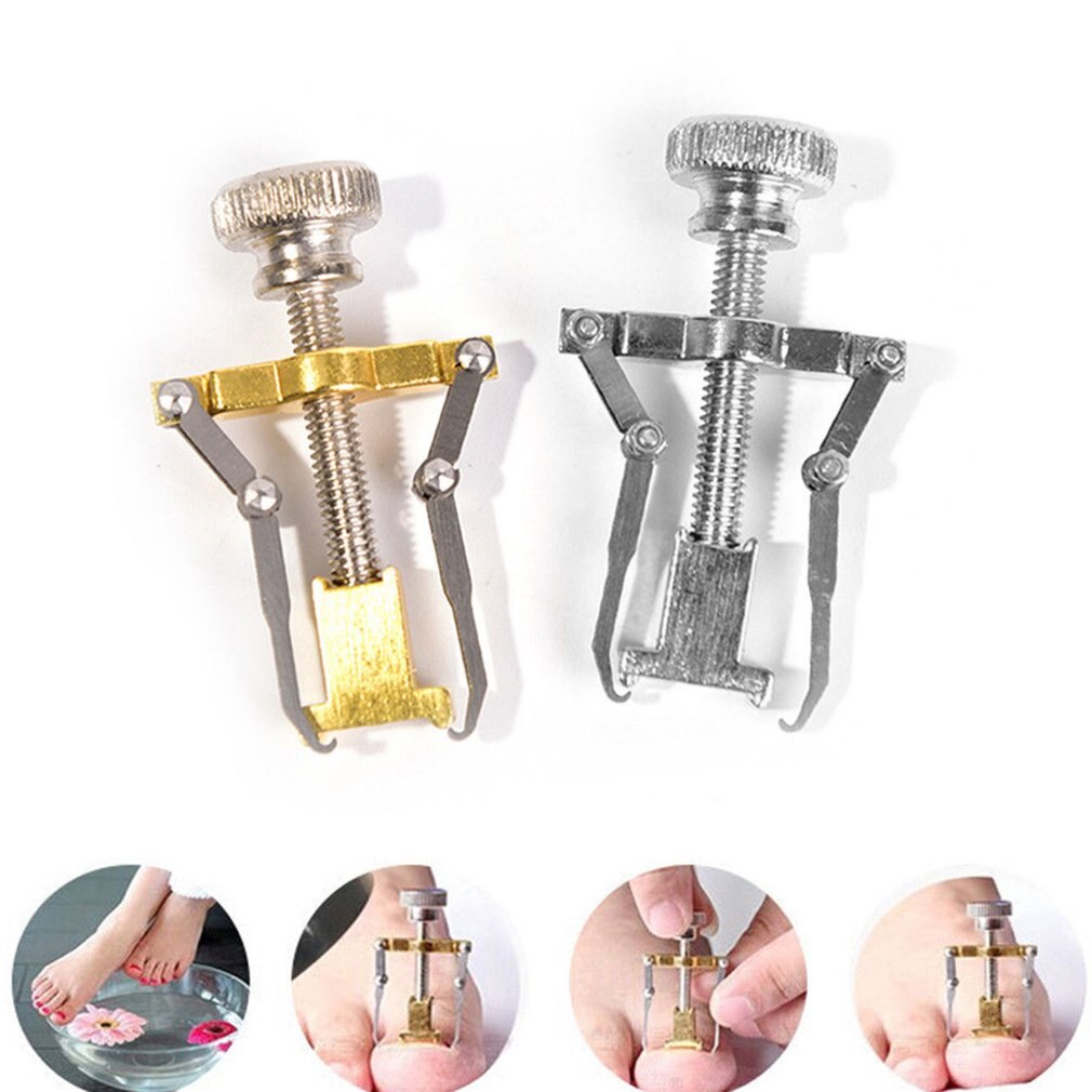 Outil de Correction d'ongles incarnés, tondeuse de manucure et pédicure, récupération Pro, soins des pieds, correcteur orthopédique d'oignon des ongles
