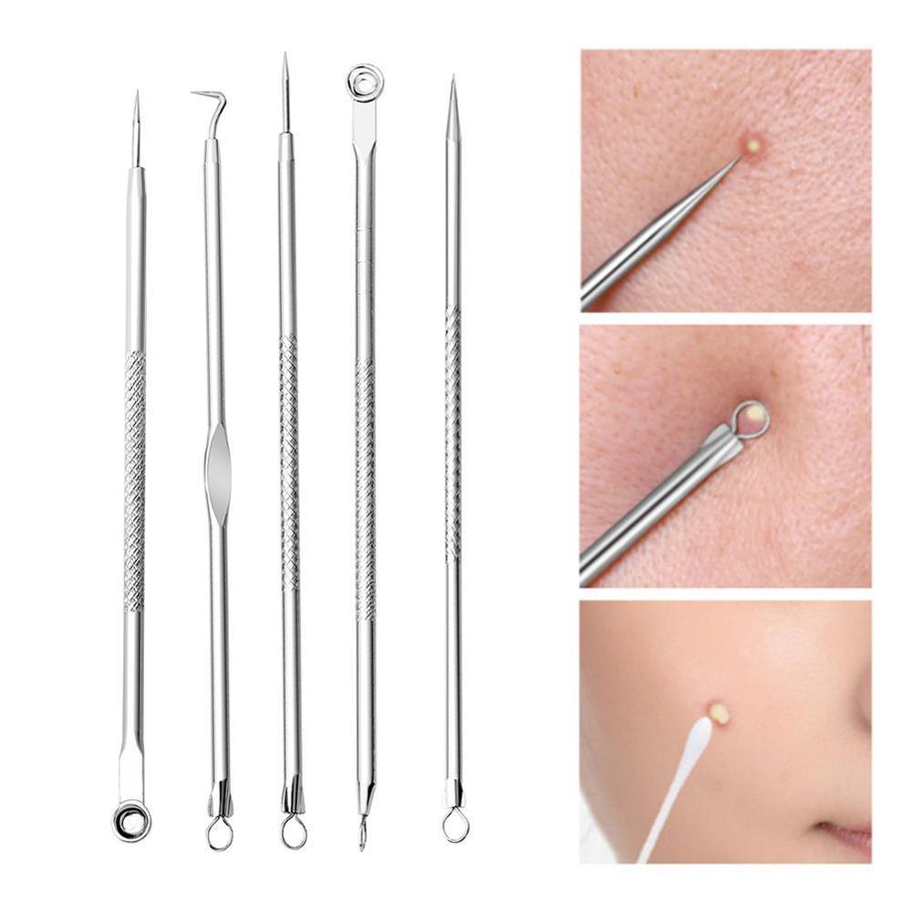 Set van 5 mee-eters, puistjes, comedonen en acne-extractornaalden ( p4 6 0 stuks)