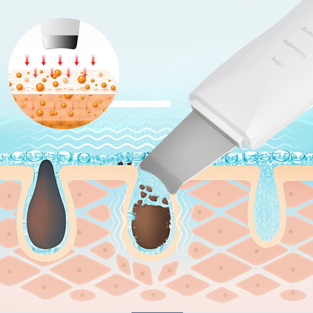 Máquina de limpeza, esfoliação e purificação ultrassônica, limpa profundamente os poros da pele do rosto