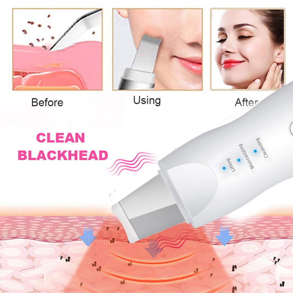 Appareil électrique de gommage de la peau, dissolvant de points noirs, spatule de Peeling du visage, Machine de Lifting du visage, amincissant, masseur à rouleau