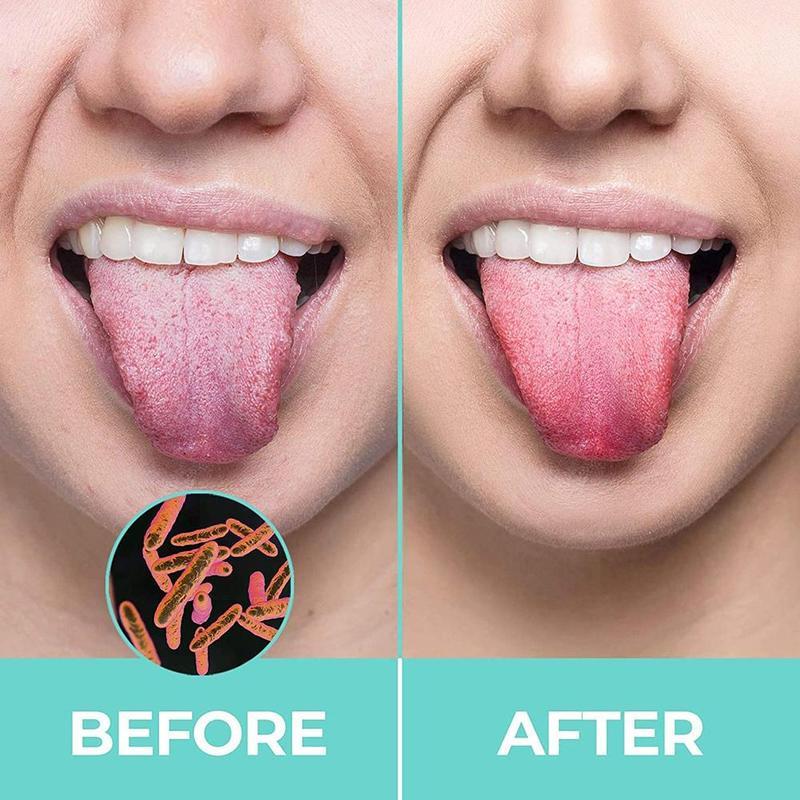 1PCS Tongue Scraper Steel Tongue Cleaner Toothbrush Hygiene High Brush Tongue Y8F1