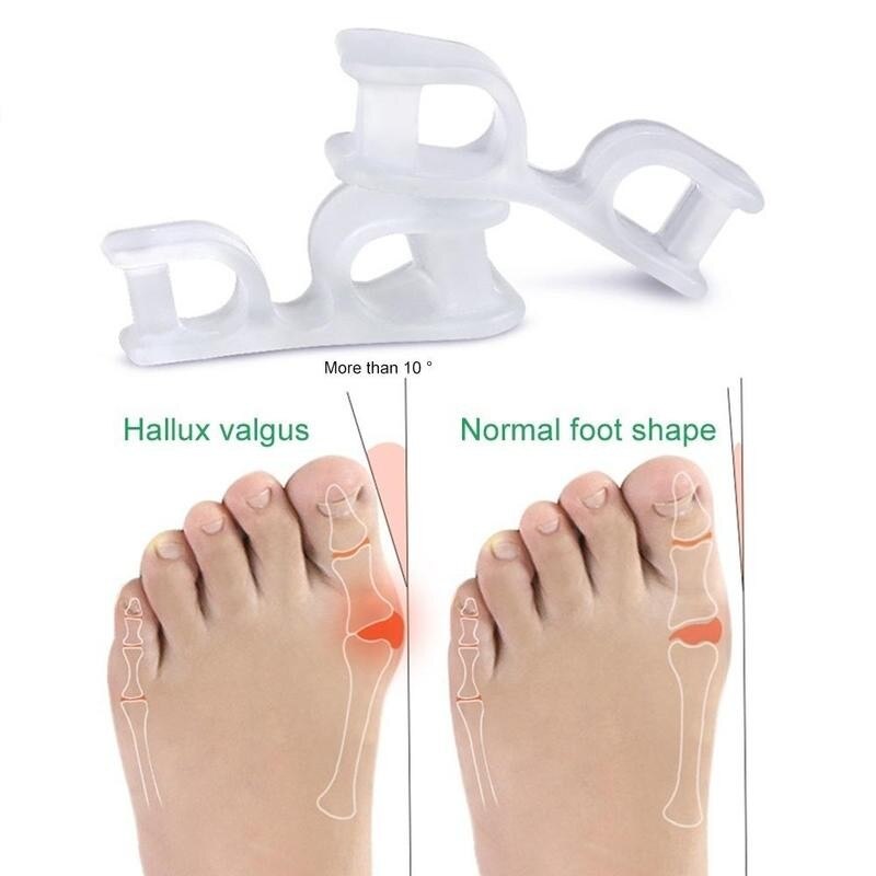 2 kpl = 1 pari ortoosi jalkojen hoito pedikyyri tarvikkeet silikoni geeli kaksireikäinen varpaan erotin suojelija bunion hallux valgus säädin
