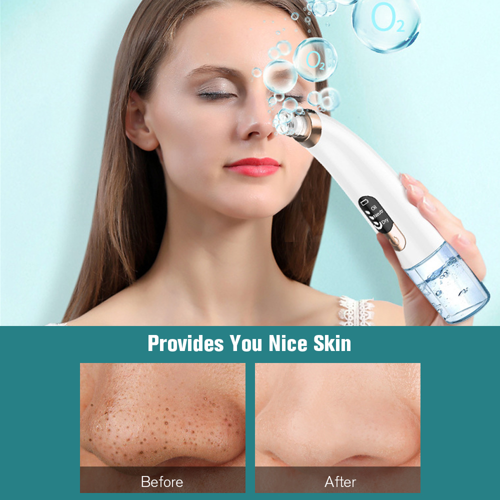 2022 Electric Blackhead Remover Suction Device Household Face Pore Cleaner Cosmetic Instrument Black Head Remover Tool