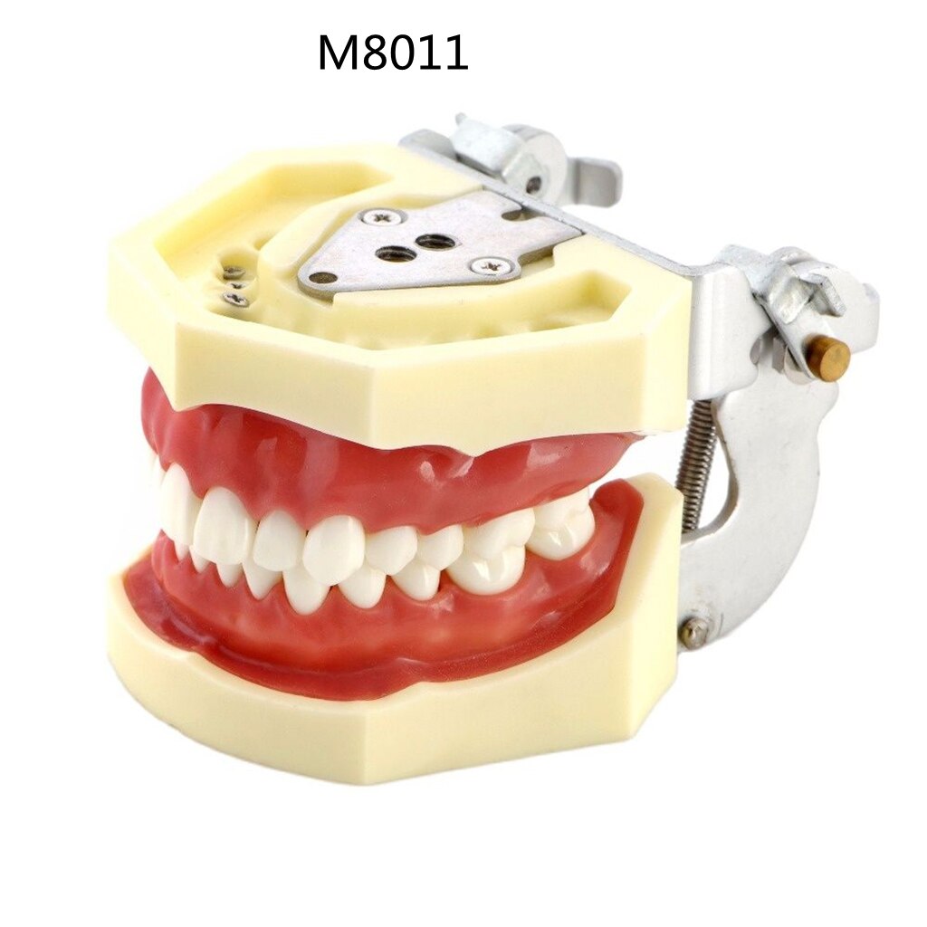 Modello Isolato Dei Denti Della Carie Di Dimostrazione Del Dentista Fotografia Stock - Immagine