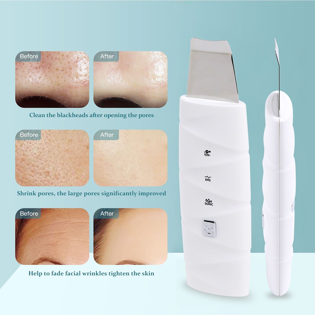 Ultrasonic face cleaning cosmetics machine effective smooth skin Facial Pore Cleaner Rechargeable Skin Scrubber