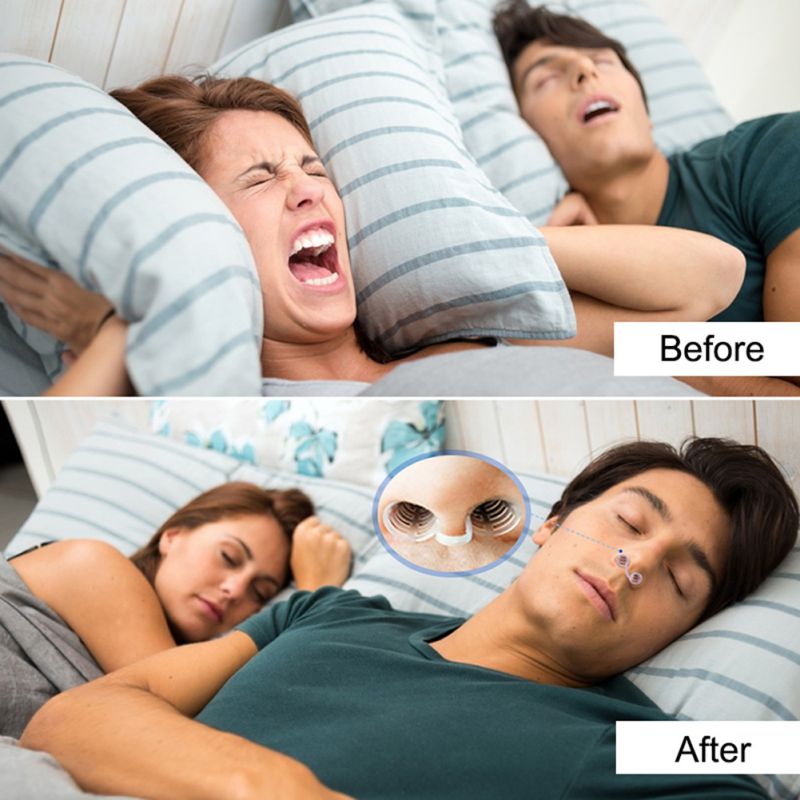 1 Box Anti-Snoring Nose Vents Soft Silicon Stop Snoring Device Night Sleep Nose Clip Device Snore Buster Anti Snore Bruxismo