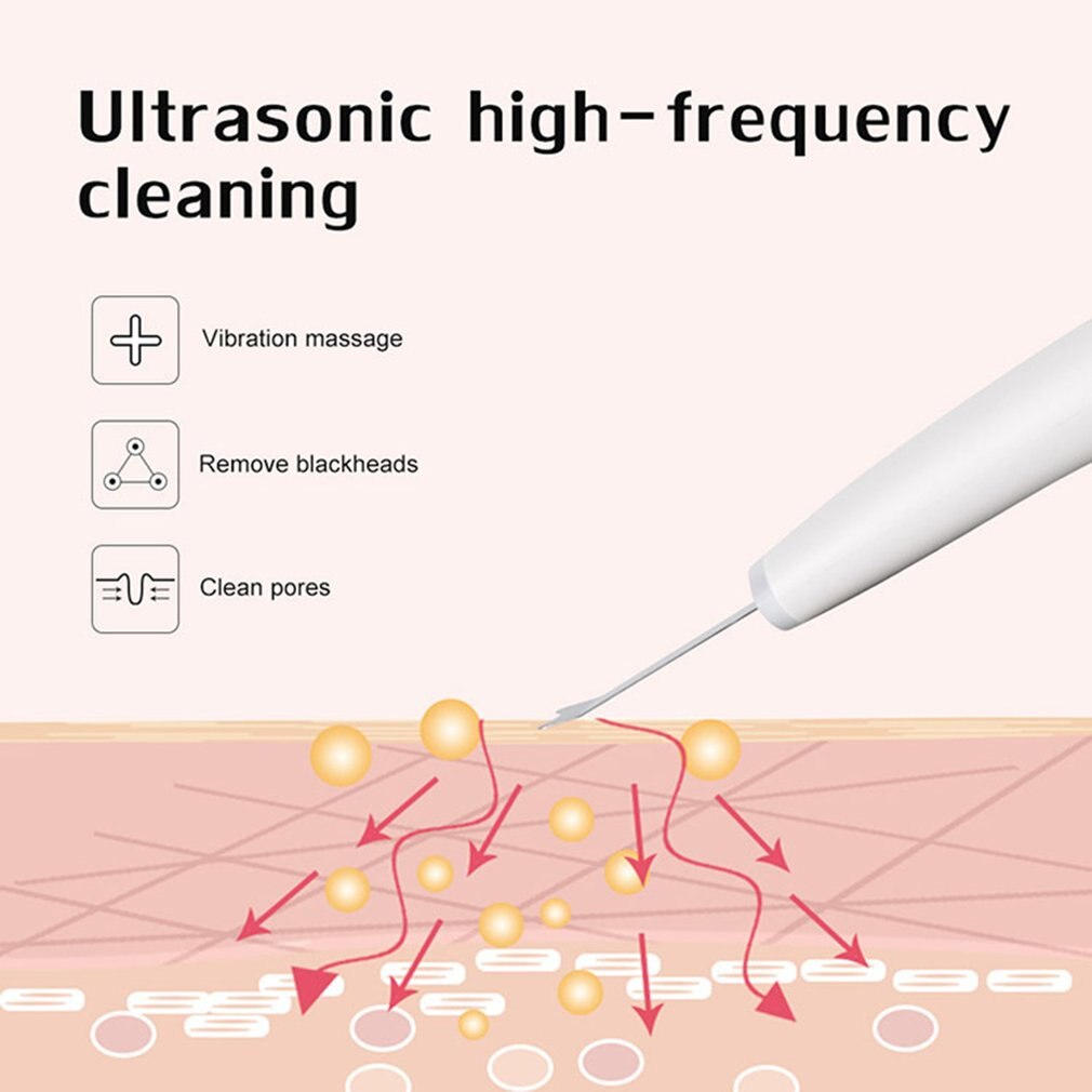 Ultrasone Schop Huid Peeling Mee-eter Om Dode Huid Schop Huid Reinigen