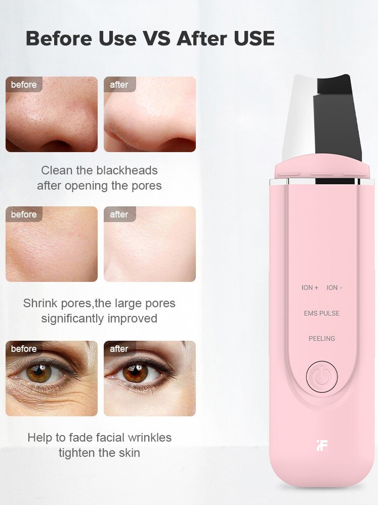 inface scrubber in face peeling facial deep clear rechargeable beauty tool Facial Massager for girl