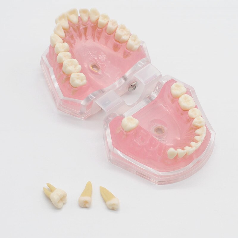 Modelo de enseñanza de goma suave extraíble, modelo tipodno para estudio de laboratorio Dental