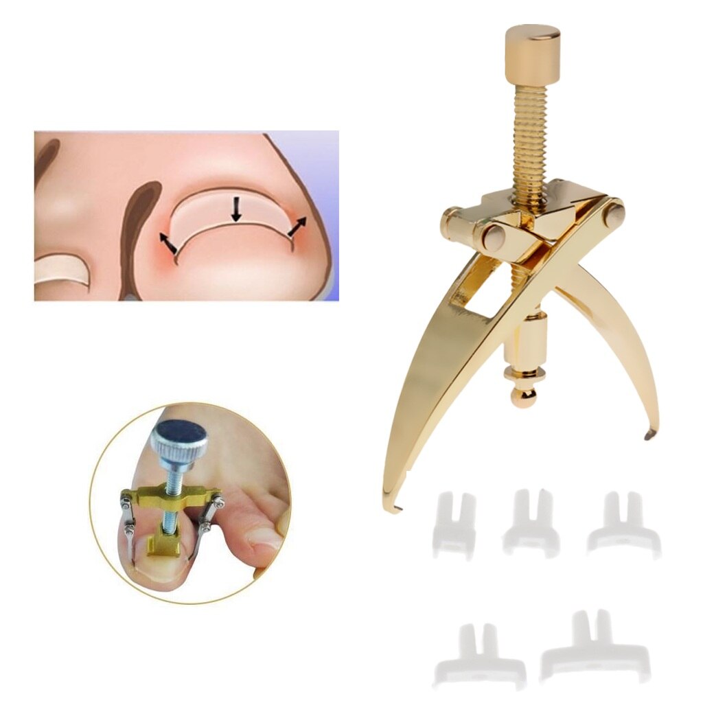 Indgroede tånegle korrigeringsværktøj manicure klipper pedicure fixer genopretningsværktøj teen negle korrigerende værktøj
