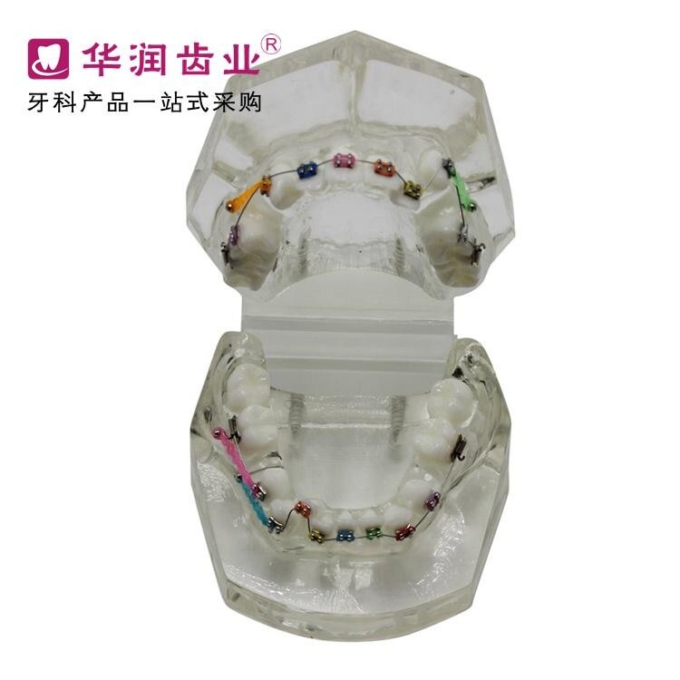 Patiënt Communicatie Model Tandheelkunde Tanden Orthodontische Model