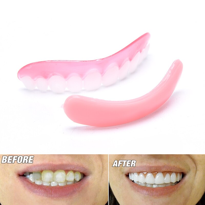 Chapa superior para dentadura con sonrisa perfecta, cuidado dental blanqueador, dentadura postiza, 1 unidad