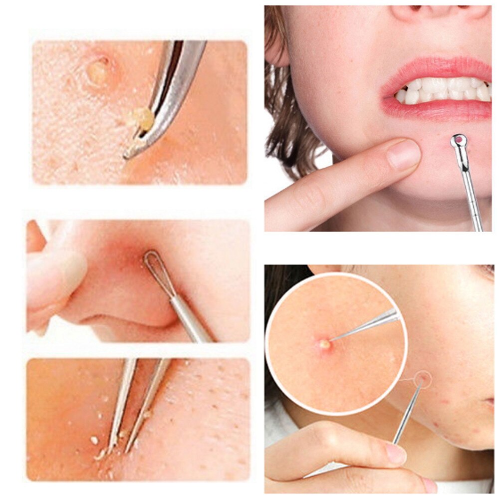 5Pcs Stainless Steel Acne Removal Needle Blackhead Remover Needle For Health Care Facial Cleansing Blackhead Extraction Tool 219