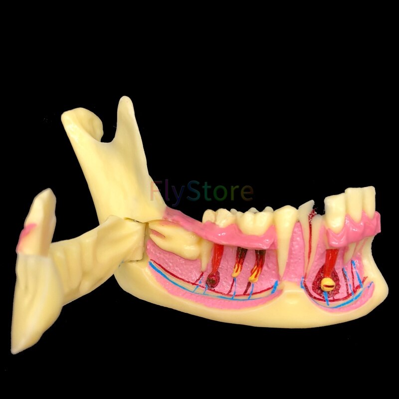 Dental Mandibular Teaching Model Teeth Demonstration Anatomical Study