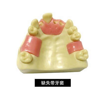 1PCS Dental Mandibular Demonstration Oral Model Implant Practice Maxillary Sinus Teaching Model Soft Gum Training Teeth model: F