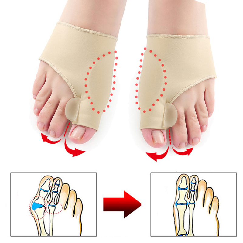 Hallux Valgus Ballen Korrektor Orthopädische Fuß Werkzeuge Knochen Daumen Erzähler Klammer Pedikübetreffend Socken Fuß Zehe Separatoren Bahre