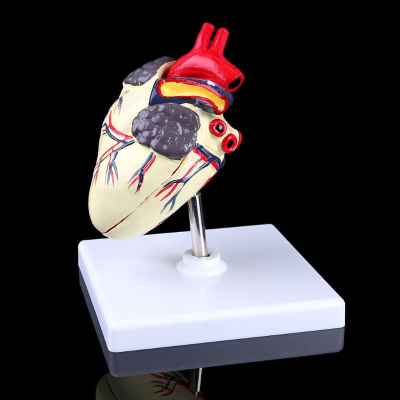 4D-ademhalingssysteemmodel, Ademhalingslongmodel met Verwijderbaar Hart Anatomische Weergave van Menselijke Longen Menselijk Longmodel Onderwijsdisplay voor Wetenschappelijk