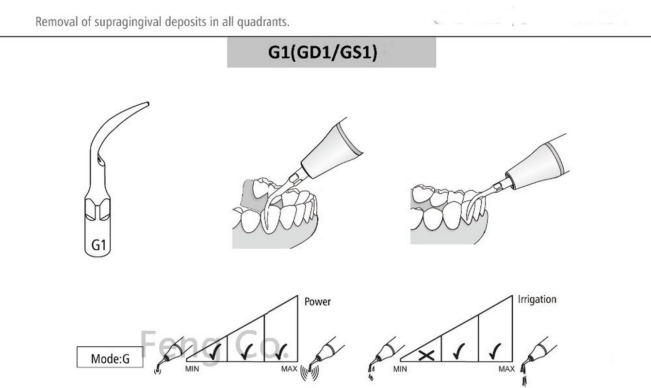 GS1 GS2 GS3 GS4 GS5 GS6 GS7 GS8 Ultrasone Scaler T... – Vicedeal