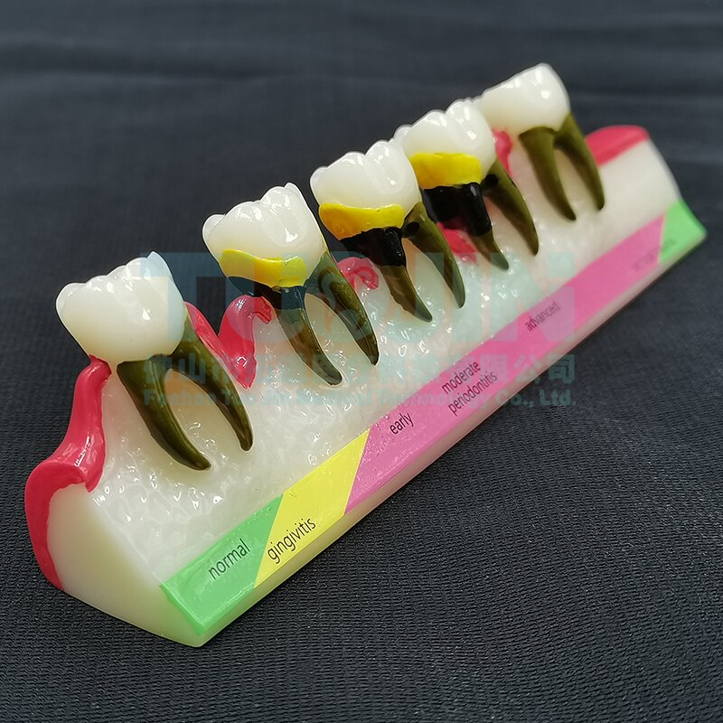 Dental Harz Zähne Tipodont Modell Für Dental Techniker Praxis Lehre Gum Zähne Kiefer Modell Zahnmedizin Ausrüstung: TYPE 6