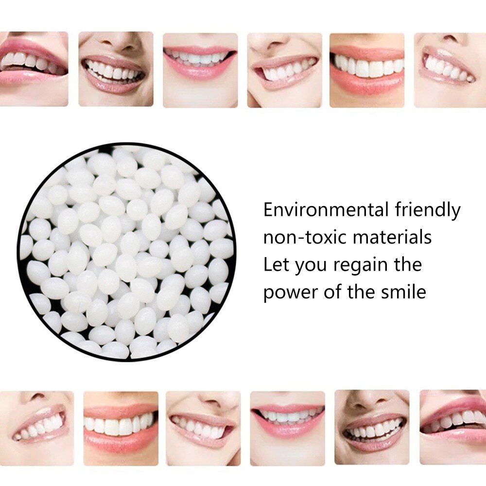 15g midlertidigt tandudskiftningsmateriale tandfyldningstempel udskift mangler tandproteseklæber diy tænder reparation dental  #45