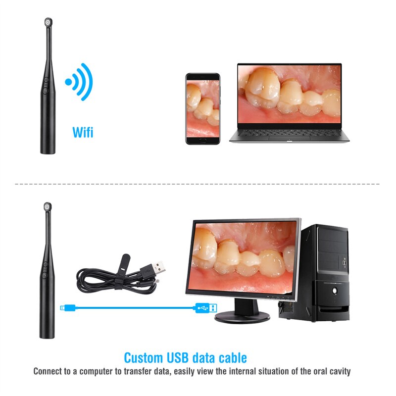 WIFI Dental Spiegel Oral Endoskop Intraorale Kamera USB Inspektion Oral HD Video Zähne Inspektion Zahn Zahn Zähne Bleaching
