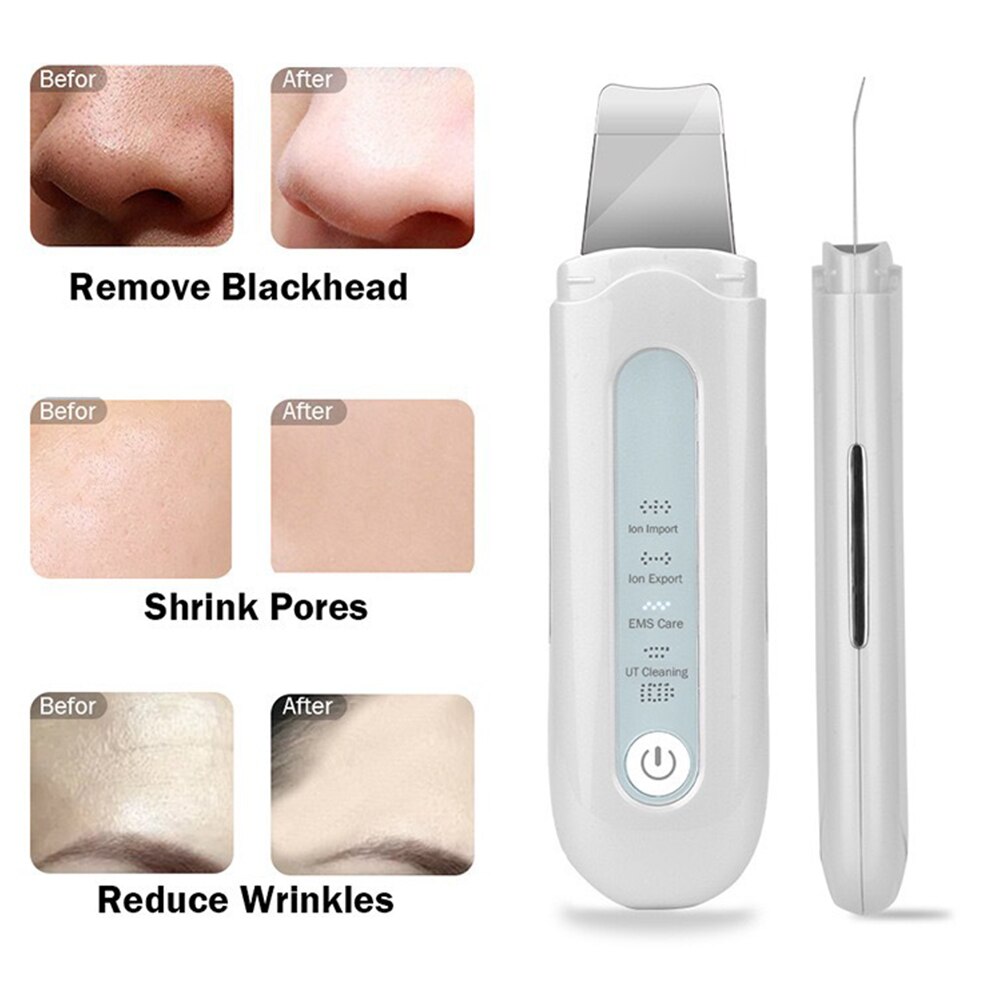EMS Face Massger Ultrasonic Skin Scrubber Blackhead Remover Pore Cleaning Face Moisturizing Wrinkle Remover Face Lifting Machine