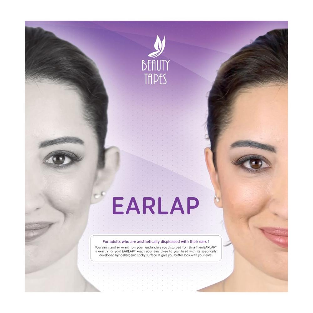 Oorlap oorcorrectortapes voor afstaande oren. geschikt voor pasgeborenen en volwassenen. otostick. arrilis beste oorcorrector.