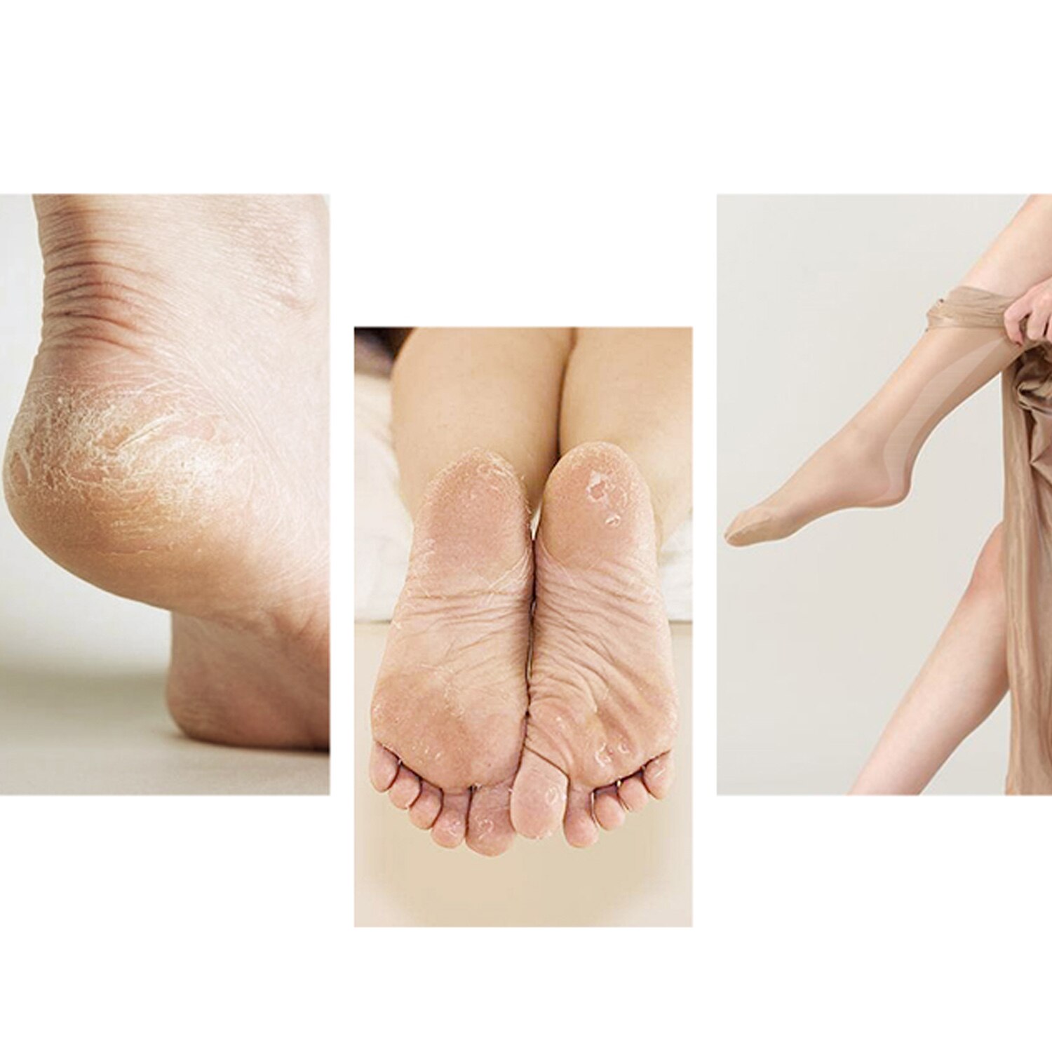 2/6pcs Pedicure Refill Roller Electronic Foot File Tool Refill Roller Repair Tool Foot Care Pedicure Machine Head Foot Scrubber