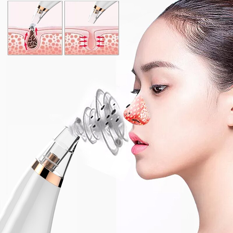 Vacuum Pore Cleaner Blackheads Electric Acne Clean Exfoliating Cleansing face Facial Instrument Comedones Remover Face Skin Car