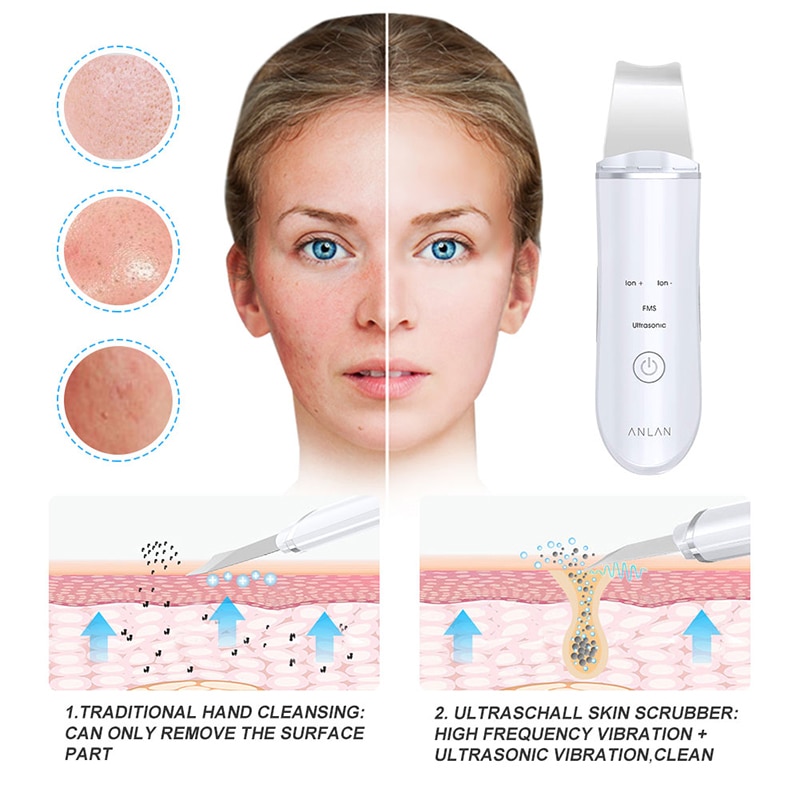 ANLAN Ultrasonic Skin Scrubber Facial Clean Machine Vibration Cleansing Removal Blackhead Exfoliating Rechargeable skin scrubber